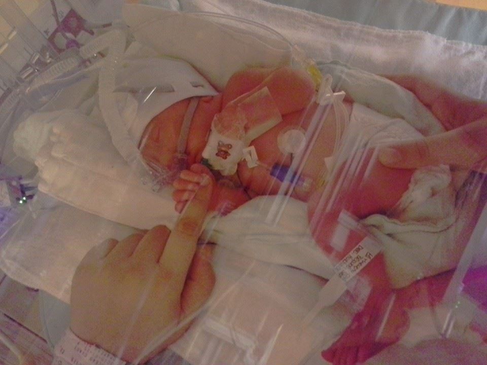 Bébé prématuré, dans un incubateur. Il a des fils, un appareil pour l'aider à respirer. On voit une main de sa mère sur sa couche et l'autre main devant lui, il en tient l'index.